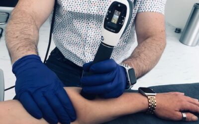 Shockwave therapue bij Fysiotherapie Schinnen Fysiotherapeut Johan zet shockwave therapie in op de arm van een patiënt